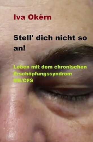 Stell dich nicht so an! Leben mit dem chronischen Erschöpfungssyndrom ME /CFS