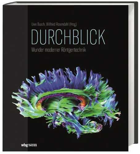 Die Welt im Durchblick — Wilfried Rosendahl