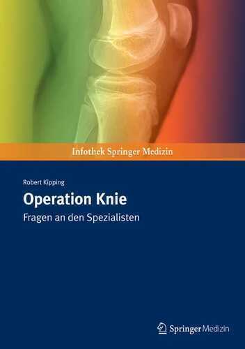 Operation Knie: Fragen an den Spezialisten