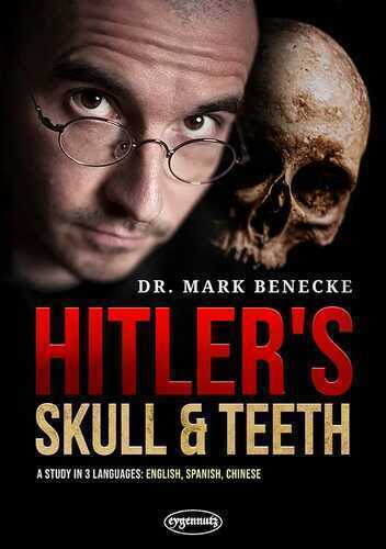 Hitler's Skull and Teeth