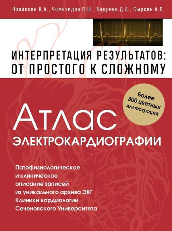 АТЛАС ЭЛЕКТРОКАРДИОГРАФИИ. ИНТЕРПРЕТАЦИЯ РЕЗУЛьТАТОВ. ОТ ПРОСТОГО К СЛОЖНОМУ