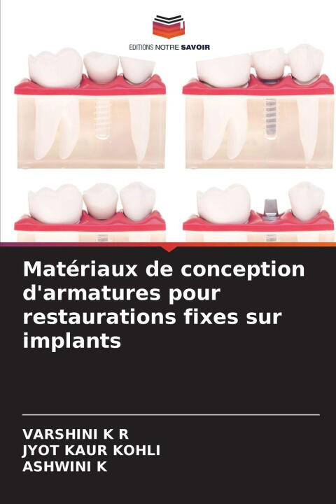 Matériaux de conception d'armatures pour restaurations fixes sur implants — VARSHINI K R