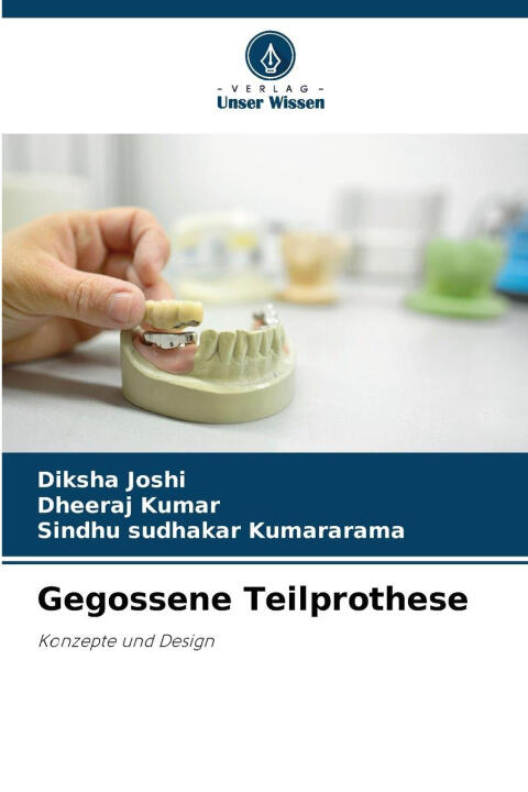 Gegossene Teilprothese