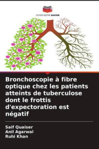 Bronchoscopie à fibre optique chez les patients atteints de tuberculose dont le frottis d'expectoration est négatif — Anil Agarwal