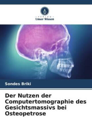 Der Nutzen der Computertomographie des Gesichtsmassivs bei Osteopetrose