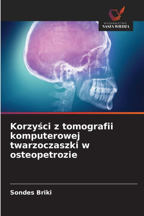 Korzysci z tomografii komputerowej twarzoczaszki w osteopetrozie