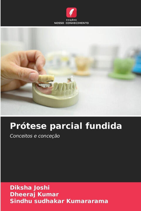 Prótese parcial fundida