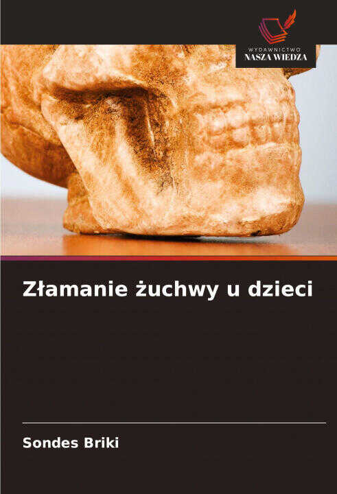 Z¿amanie ¿uchwy u dzieci