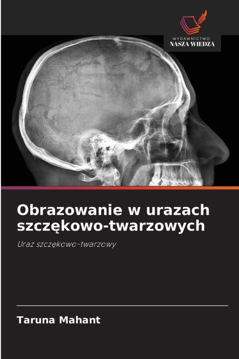 Obrazowanie w urazach szczekowo-twarzowych