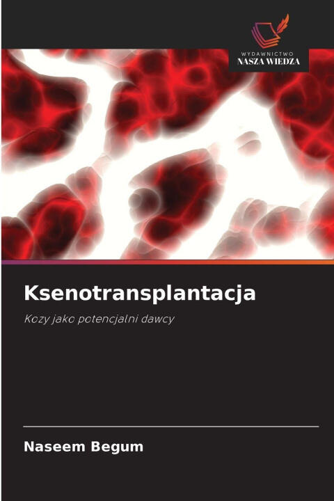 Ksenotransplantacja