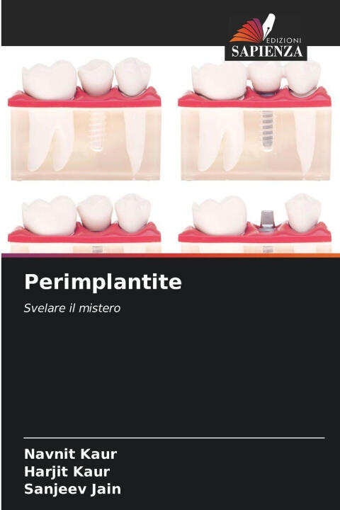 Perimplantite