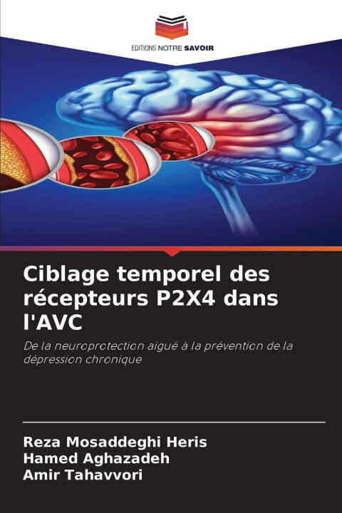 Ciblage temporel des récepteurs P2X4 dans l'AVC — Reza Mosaddeghi Heris