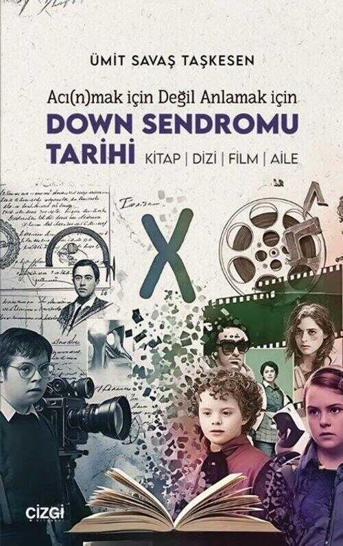 Down Sendromu Tarihi