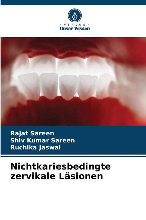 Nichtkariesbedingte zervikale Läsionen
