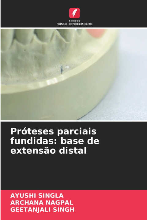 Próteses parciais fundidas
