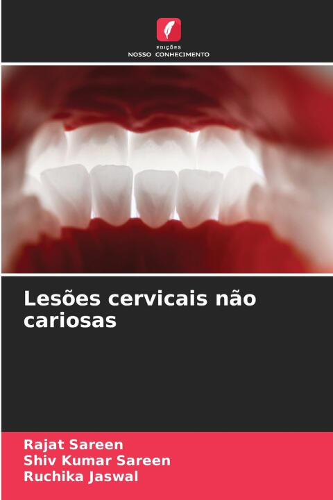 Lesões cervicais não cariosas