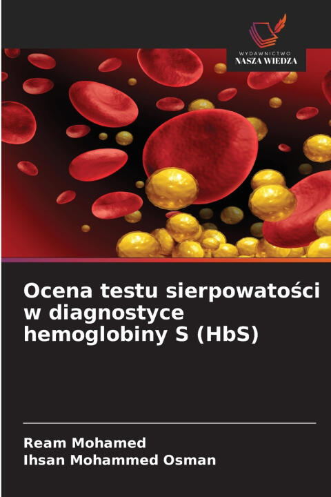 Ocena testu sierpowatości w diagnostyce hemoglobiny S (HbS)