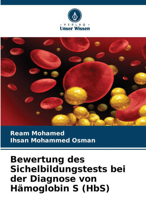Bewertung des Sichelbildungstests bei der Diagnose von Hämoglobin S (HbS)