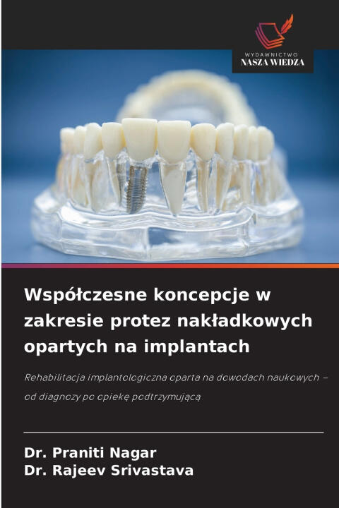 Współczesne koncepcje w zakresie protez nakładkowych opartych na implantach