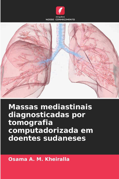 Massas mediastinais diagnosticadas por tomografia computadorizada em doentes sudaneses