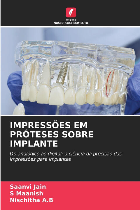 Impressões Em Próteses Sobre Implante — Saanvi Jain