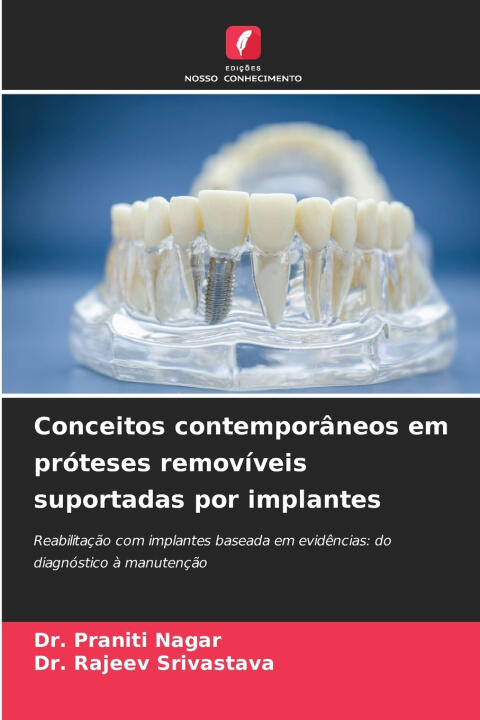 Conceitos contemporâneos em próteses removíveis suportadas por implantes