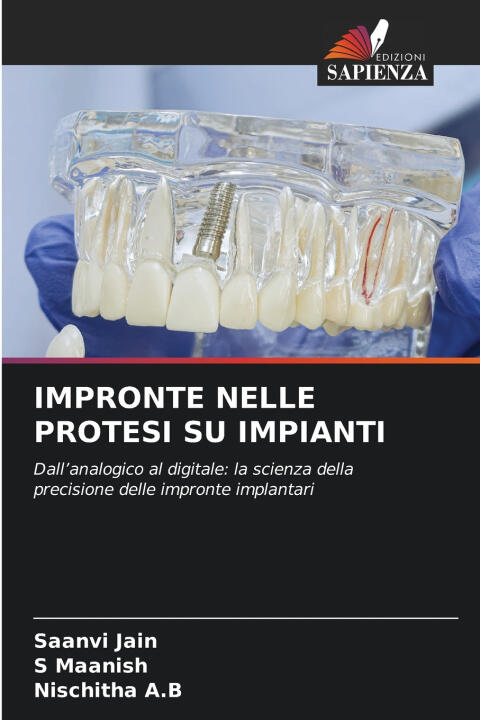 Impronte Nelle Protesi Su Impianti