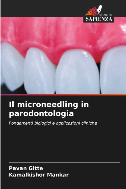 Il microneedling in parodontologia