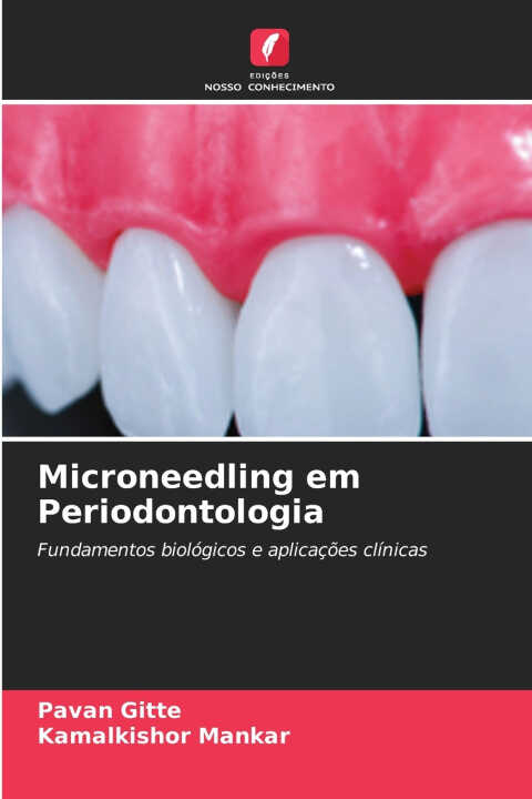Microneedling em Periodontologia