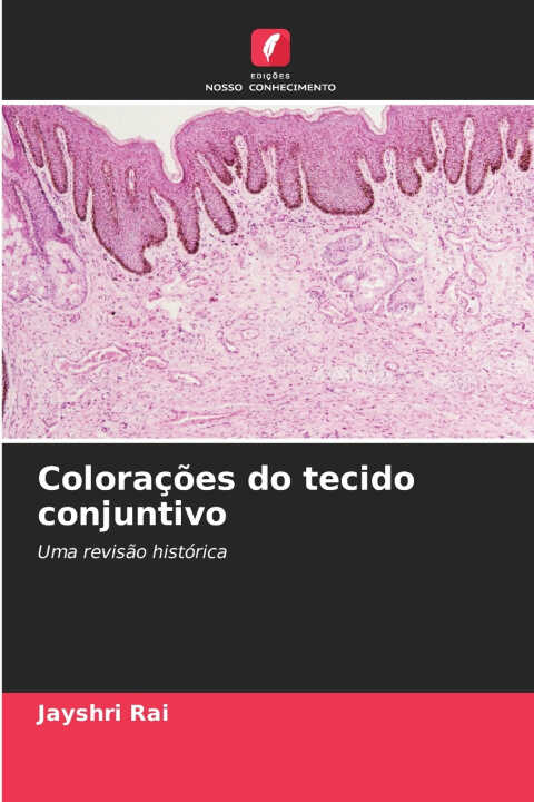 Colorações do tecido conjuntivo