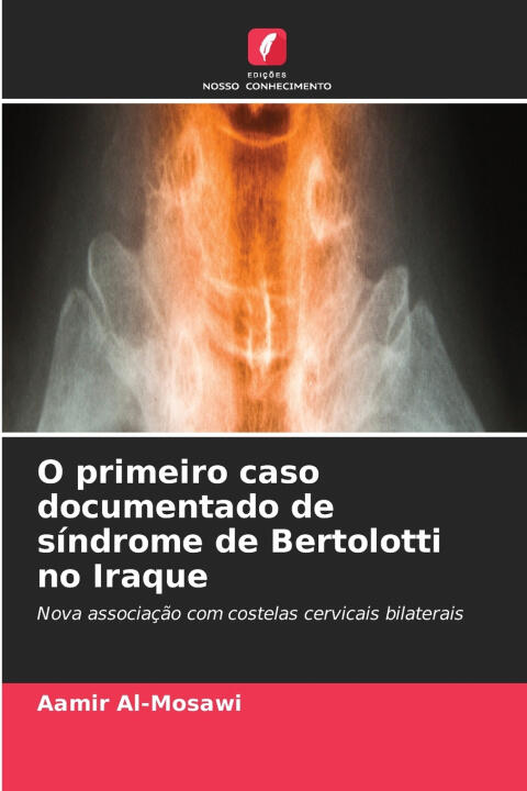 O primeiro caso documentado de síndrome de Bertolotti no Iraque — Aamir Al-Mosawi