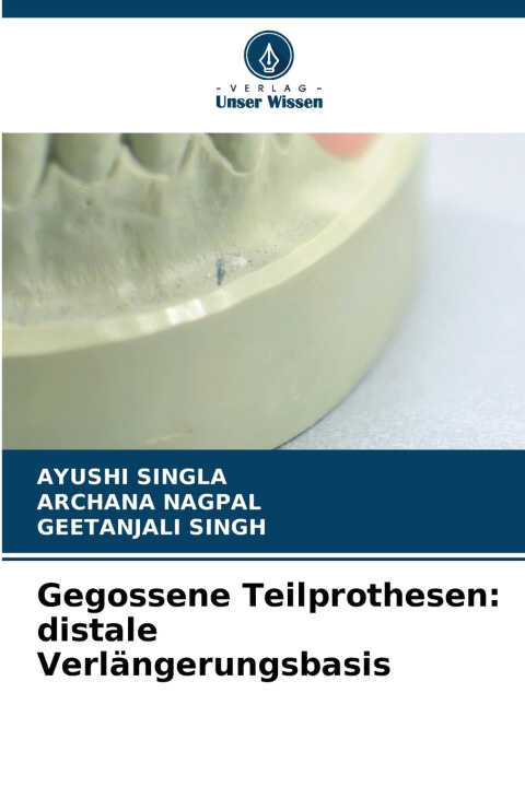 Gegossene Teilprothesen