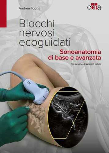 Blocchi nervosi ecoguidati. Sonoanatomia di base avanzata