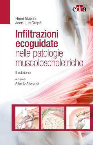 Infiltrazioni ecoguidate nelle patologie muscoloscheletriche