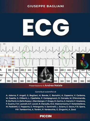 ECG