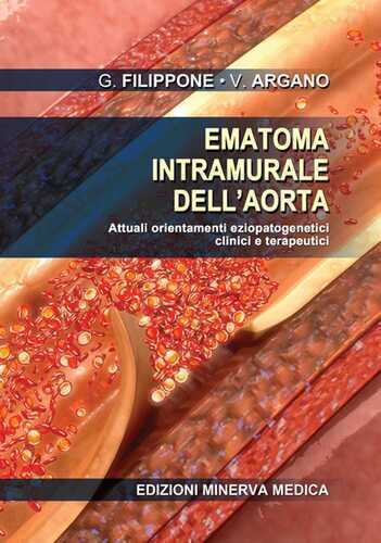 Ematoma intramurale dell'aorta. Attuali orientamenti eziopatogenetici clinici e terapeutici