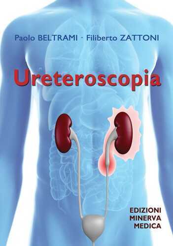 Ureteroscopia — Paolo Beltrami