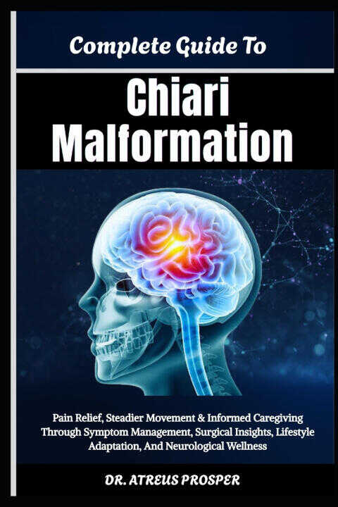 Complete Guide To Chiari Malformation